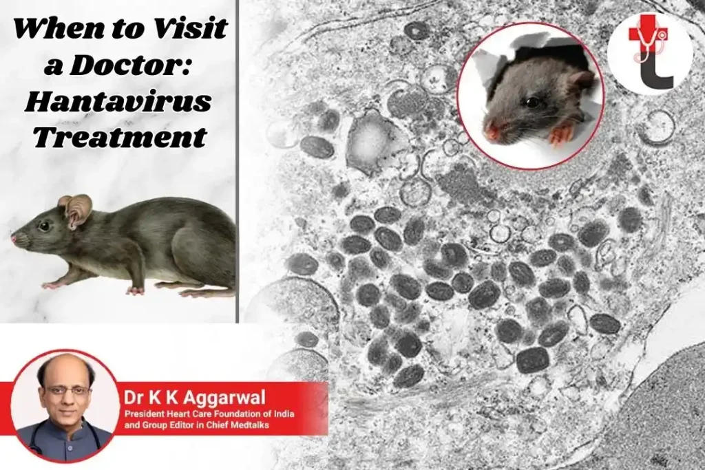When to Visit a Doctor Hantavirus Treatment_11zon
